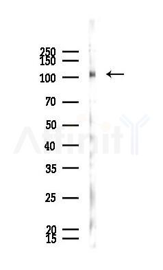 Phospho-ROS (Tyr2114) Antibody - Western blot analysis of lysates from HUVEC cells(UV 30min treatment), using Phospho-ROS (Tyr2114) Antibody at 1/1000 dilution.