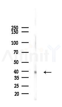 Phospho-TGFBR1 (Thr204) Antibody - Western blot analysis of lysates from Mouse heart, using Phospho-TGFBR1 (Thr204) Antibody at 1/1000 dilution.