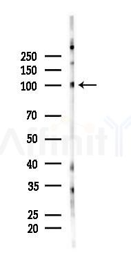 Phospho-APP (Thr729) Antibody - Western blot analysis of lysates from A2780 cells(starvation 24h treatment), using Phospho-APP (Thr729) Antibody at 1/1000 dilution.