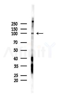 Phospho-APP (Thr729) Antibody - Western blot analysis of lysates from Hela cells(starvation 24h treatment), using Phospho-APP (Thr729) Antibody at 1/1000 dilution.