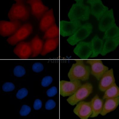 Phospho-APP (Thr729) Antibody - AF8461 staining Hela cells(45min of heat-shock treatment) by IF/ICC.
