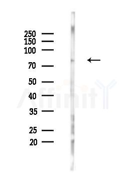 Phospho-DRP1 (Ser616) Antibody - Western blot analysis of lysates from HUVEC cells(UV 30min treatment), using Phospho-DRP1 (Ser616) Antibody at 1/1000 dilution.