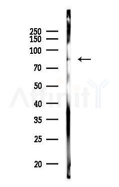 Phospho-DRP1 (Ser616) Antibody - Western blot analysis of lysates from Rat heart, using Phospho-DRP1 (Ser616) Antibody at 1/1000 dilution.