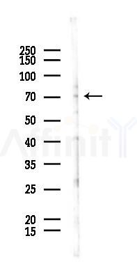 Phospho-DRP1 (Ser616) Antibody - Western blot analysis of lysates from PC12 cells(UV 30min treatment), using Phospho-DRP1 (Ser616) Antibody at 1/1000 dilution.