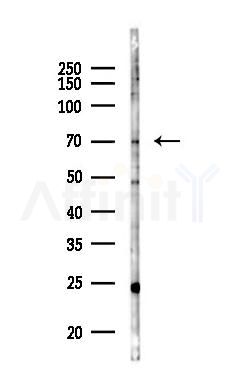 Phospho-G3BP-1 (Ser149) Antibody - Western blot analysis of lysates from PC12 cells(UV 30min treatment), using Phospho-G3BP-1 (Ser149) Antibody at 1/1000 dilution.
