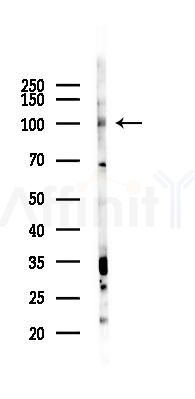 Phospho-EZH2 (Thr367) Antibody - Western blot analysis of lysates from K562 cells(UV 30min treatment), using Phospho-EZH2 (Thr367) Antibody at 1/1000 dilution.