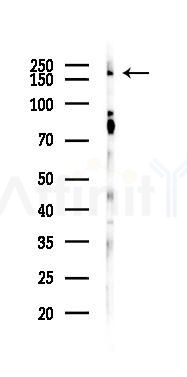 Phospho-DEPDC5 (Thr1531) Antibody - Western blot analysis of lysates from K562 cells(UV 30min treatment), using Phospho-DEPDC5 (Thr1531) Antibody at 1/1000 dilution.