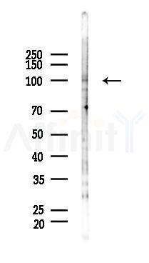 Phospho-EZH2 (Ser475) Antibody - Western blot analysis of lysates from 293 cells(UV 30min treatment), using Phospho-EZH2 (Ser475) Antibody at 1/1000 dilution.