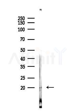 Phospho-MLC2 (Ser15) Antibody - Western blot analysis of lysates from Mouse brain, using Phospho-MLC2 (Ser15) Antibody at 1/1000 dilution.