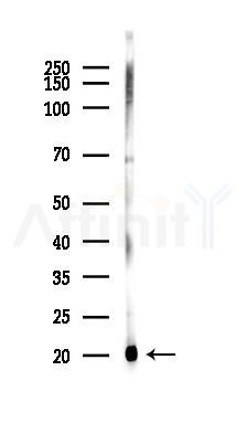 Phospho-MLC2 (Ser15) Antibody - Western blot analysis of lysates from Mouse muscle, using Phospho-MLC2 (Ser15) Antibody at 1/1000 dilution.