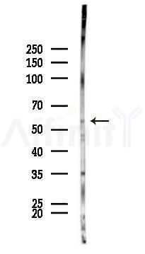 Arylsulfatase K Antibody - Western blot analysis of lysates from B16F10-LUC cells(UV 30min treatment), using Arylsulfatase K Antibody at 1/1000 dilution.