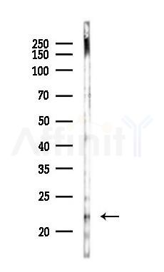 HP1 gamma Antibody - Western blot analysis of lysates from PC12 cells(UV 30min treatment), using HP1 gamma Antibody at 1/1000 dilution.