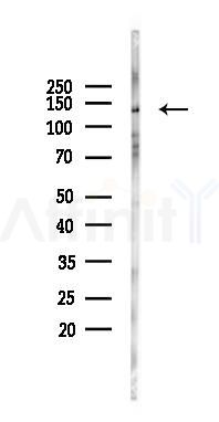 KCNT1 Antibody - Western blot analysis of lysates from 293 cells(UV 30min treatment), using KCNT1 Antibody at 1/1000 dilution.
