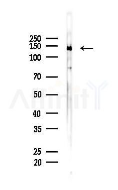 KCNT1 Antibody - Western blot analysis of lysates from 293 cells(heat-shock 45min treatment), using KCNT1 Antibody at 1/1000 dilution.