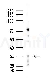 Nanog P8 Antibody - Western blot analysis of lysates from Hela cells(starvation 24h treatment), using Nanog P8 Antibody at 1/1000 dilution.