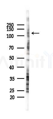 SCAF1 Antibody - Western blot analysis of lysates from PC12 cells(starvation 24h treatment), using SCAF1 Antibody at 1/1000 dilution.