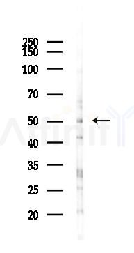 ZNF785 Antibody - Western blot analysis of lysates from K562 cells(UV 30min treatment), using ZNF785 Antibody at 1/1000 dilution.