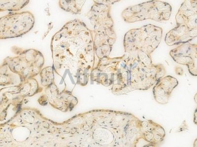 AKT1/2/3 Recombinant Rabbit mAb - BF3003 at 1/100 staining Human placental tissue by IHC-P.