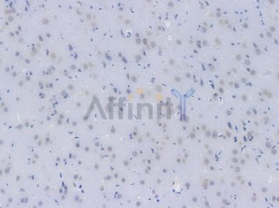 Phospho-AKT1/2/3 (Ser473) Recombinant Rabbit mAb - BF3004 at 1/100 staining Rat brain tissue by IHC-P.