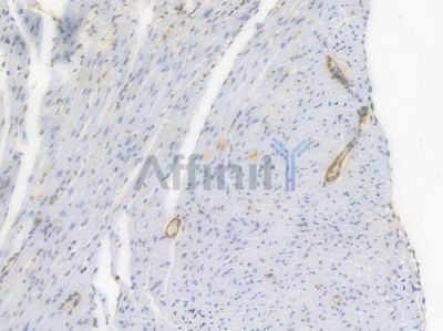 alpha-SMA Recombinant Rabbit mAb - BF3011 at 1/100 staining Mouse heart tissue by IHC-P.