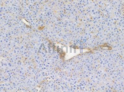 alpha-SMA Recombinant Rabbit mAb - BF3011 at 1/100 staining Mouse liver tissue by IHC-P.