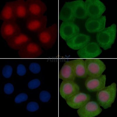 AMPK alpha 1 Recombinant Rabbit mAb - BF3012 staining Hela cells(30min of UV treatment) by IF/ICC.