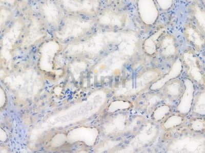 AMPK alpha 1 Recombinant Rabbit mAb - BF3012 at 1/100 staining Human renal tissue by IHC-P.
