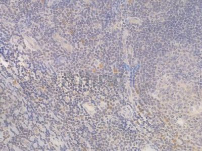 Bax Recombinant Rabbit mAb - BF3013 at 1/100 staining Human tonsil tissue by IHC-P.