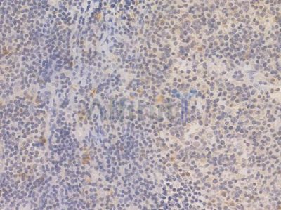 Bax Recombinant Rabbit mAb - BF3013 at 1/100 staining Human tonsil tissue by IHC-P.