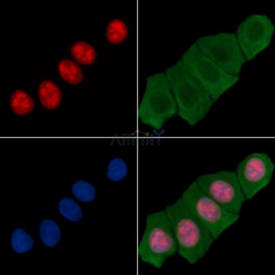 Ki67 Recombinant Rabbit mAb - BF3018 staining Hela cells(30min of UV treatment) by IF/ICC.