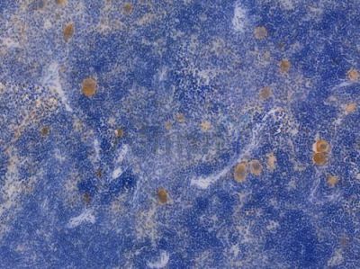 TGF beta 1 Recombinant Rabbit mAb - BF3021 at 1/100 staining Mouse spleen tissue by IHC-P.