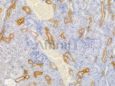 Occludin Recombinant Rabbit mAb - BF3030 at 1/100 staining Rat renal tissue by IHC-P.