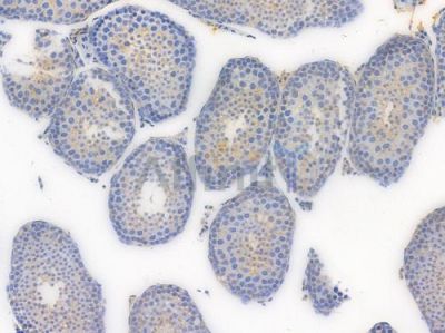 Occludin Recombinant Rabbit mAb - BF3030 at 1/100 staining Mouse testicular tissue by IHC-P.