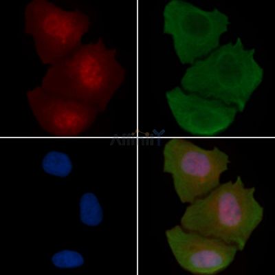 Phospho-STAT3 (Tyr705) Recombinant Rabbit mAb - BF3033 staining Hela cells(30min of UV treatment) by IF/ICC.