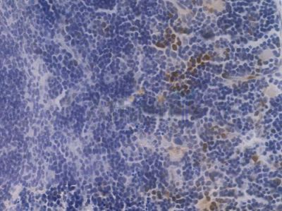 Phospho-STAT3 (Tyr705) Recombinant Rabbit mAb - BF3033 at 1/100 staining Mouse spleen tissue by IHC-P.