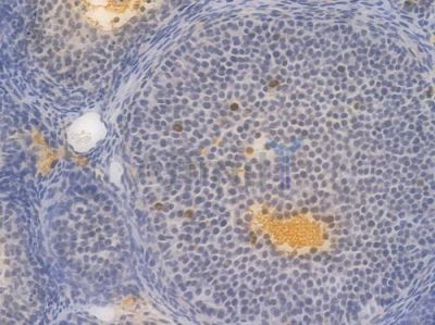 Phospho-STAT3 (Tyr705) Recombinant Rabbit mAb - BF3033 at 1/100 staining Mouse ovarian tissue by IHC-P.