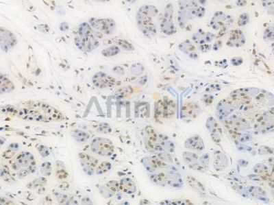 Phospho-STAT3 (Tyr705) Recombinant Rabbit mAb - BF3033 at 1/100 staining Human pancreatic tissue by IHC-P.