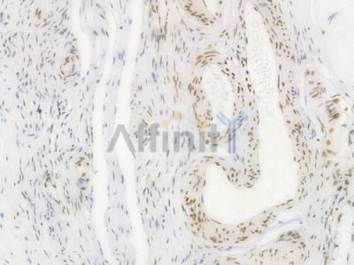 Phospho-STAT3 (Tyr705) Recombinant Rabbit mAb - BF3033 at 1/100 staining Human ovarian tissue by IHC-P.