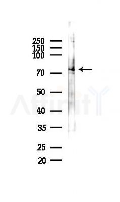 Phospho-STAT3 (Tyr705) Recombinant Rabbit mAb - Western blot analysis of lysates from RAW264.