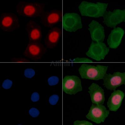Phospho-STAT3 (Ser727) Recombinant Rabbit mAb - BF3034 staining Hela cells(30min of UV treatment) by IF/ICC.