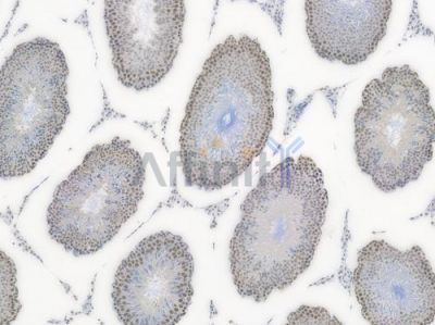 Phospho-STAT3 (Ser727) Recombinant Rabbit mAb - BF3034 at 1/100 staining Rat testicular tissue by IHC-P.