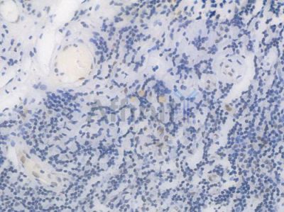 Phospho-STAT3 (Ser727) Recombinant Rabbit mAb - BF3034 at 1/100 staining Human tonsil tissue by IHC-P.