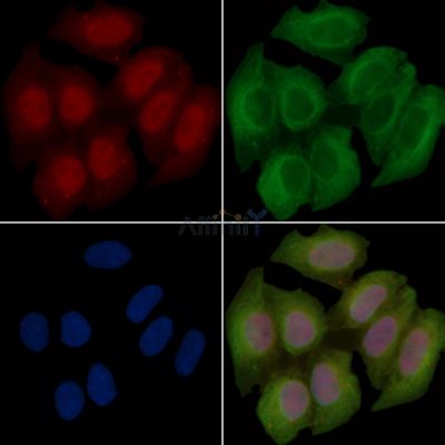 STAT3 Recombinant Rabbit mAb - BF3035 staining Hela cells(30min of UV treatment) by IF/ICC.