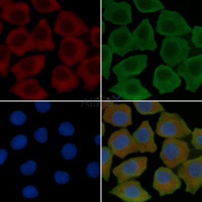 CD86 Recombinant Rabbit mAb - BF3037 staining Hela cells(30min of UV treatment) by IF/ICC.