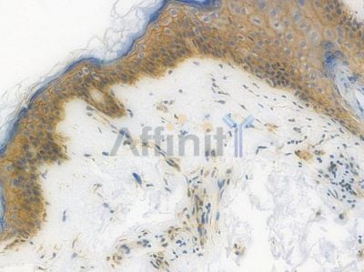 E-cadherin Recombinant Rabbit mAb - BF3043 at 1/100 staining Human skin tissue by IHC-P.