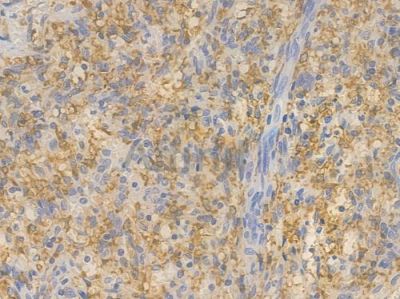 HO-1 Recombinant Rabbit mAb - BF3045 at 1/100 staining Human spleen tissue by IHC-P.