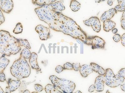 HO-1 Recombinant Rabbit mAb - BF3045 at 1/100 staining Human placental tissue by IHC-P.