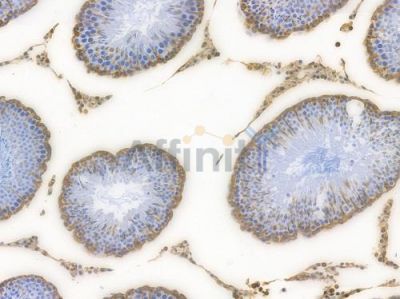 Vimentin Recombinant Rabbit mAb - BF3047 at 1/100 staining Rat testicular tissue by IHC-P.