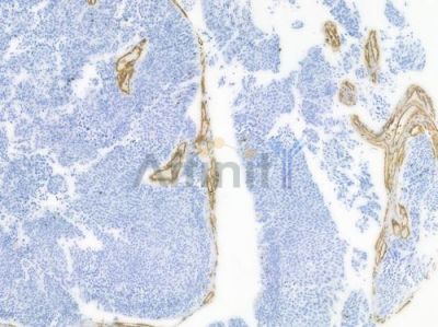 Vimentin Recombinant Rabbit mAb - BF3047 at 1/100 staining Human tonsil tissue by IHC-P.