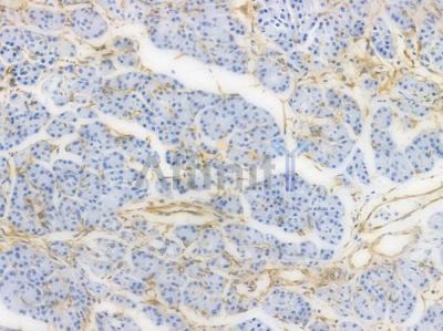 Vimentin Recombinant Rabbit mAb - BF3047 at 1/100 staining Human pancreatic tissue by IHC-P.